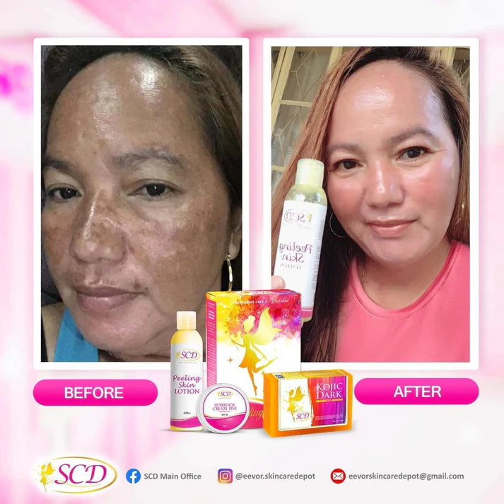 SCD Peeling Skin Lotion Set