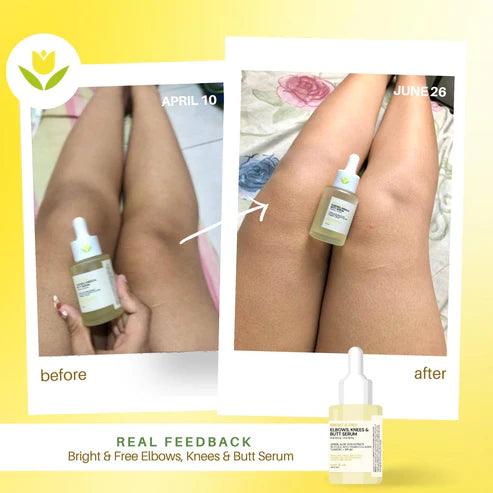 Catt & Co ELBOWS, KNEES & BUTT Serum