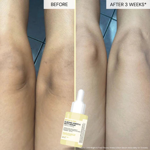 Catt & Co ELBOWS, KNEES & BUTT Serum