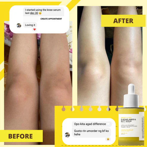 Catt & Co ELBOWS, KNEES & BUTT Serum