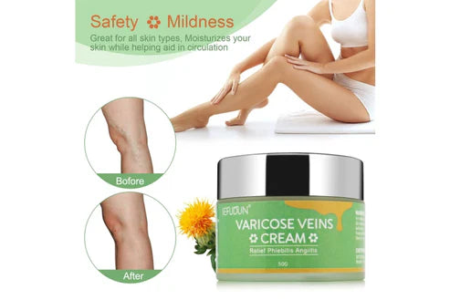 SEFUDUN Varicose Vein Cream 50g