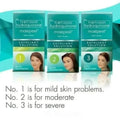 Maxi Peel Exfoliant Solution 60ml