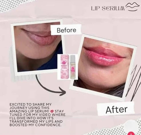 K Beauty Sweet Kiss Lip Serum 10ml