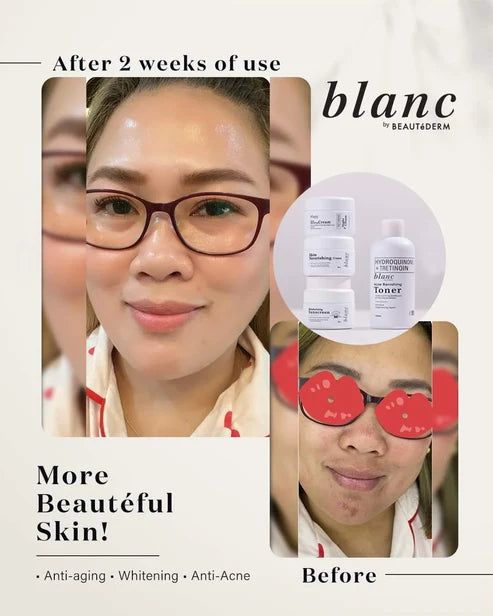 Beautederm Blanc Set