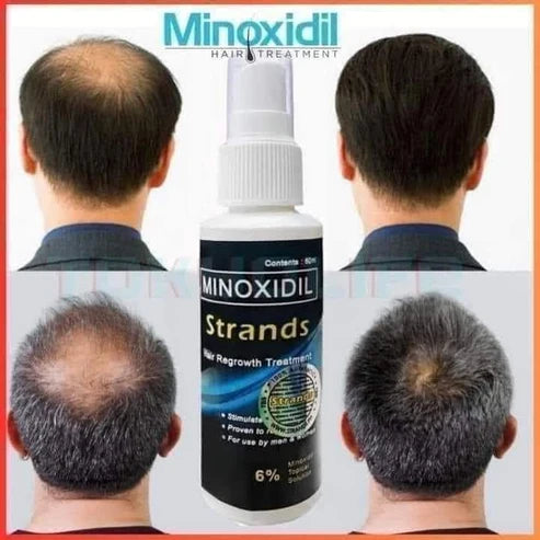 Minoxidil Strands 6% Hair Regrowth Treatment
