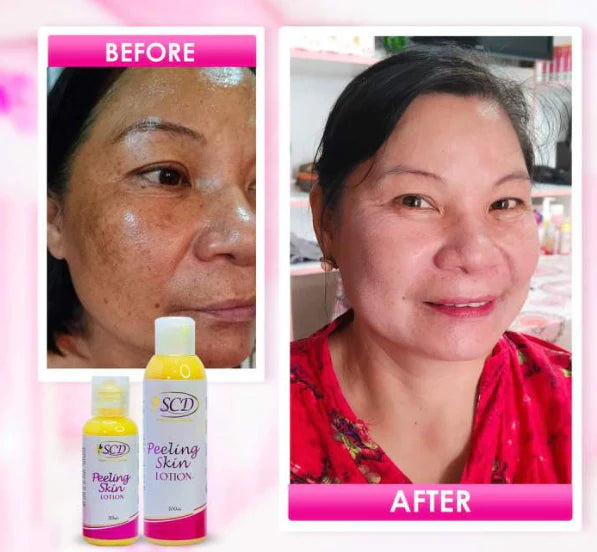 SCD Peeling Skin Lotion Set