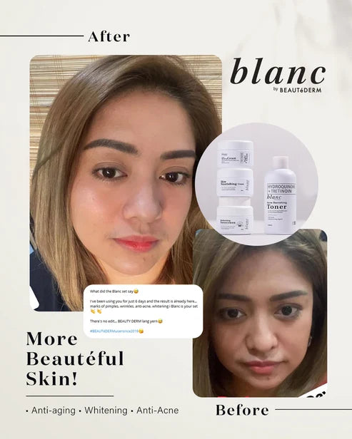 Beautederm Blanc Set