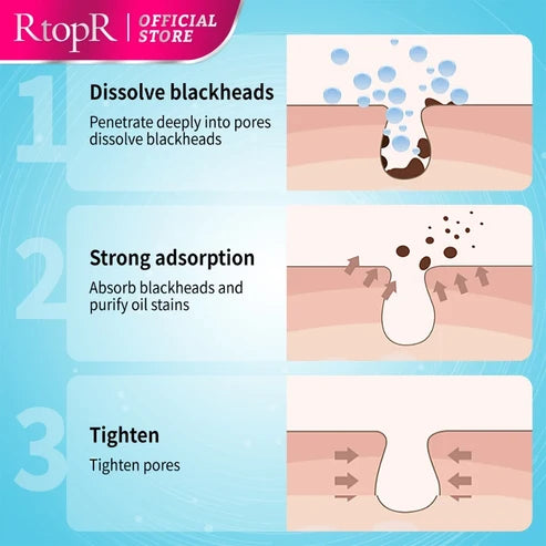 RtopR Mango Blackhead Remover Mask Peeling Off Nose Mask Oil Control 10ml+50pcs paper