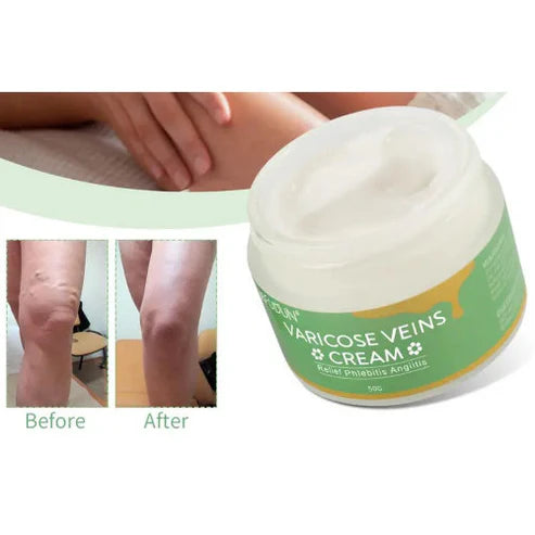 SEFUDUN Varicose Vein Cream 50g