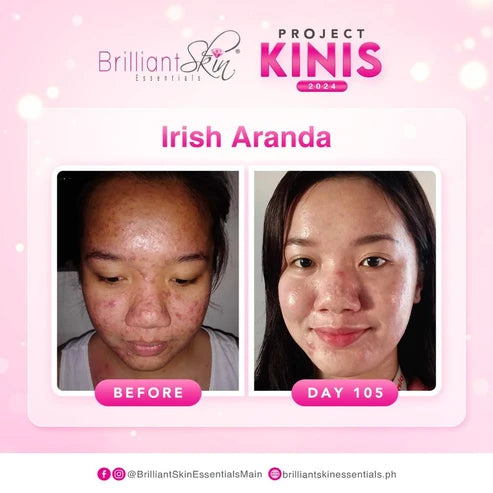 Brilliant Skin Rejuvenating Big Toner 135ml