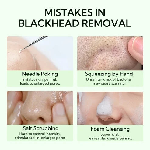 LANBENA Blackheads Removal Oil Control Shrink Pores Serum - Step1 + step2