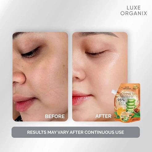 LUXE ORGANIX Aloe Vera & Snail Soothing Gel 100ml
