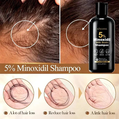 Minoxidil 5% Hair Growth 300ml Shampoo
