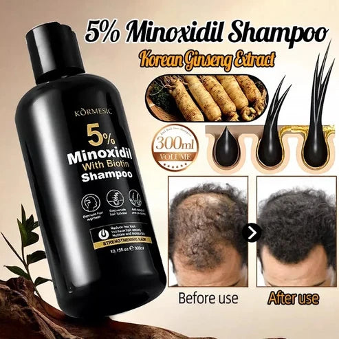 Minoxidil 5% Hair Growth 300ml Shampoo
