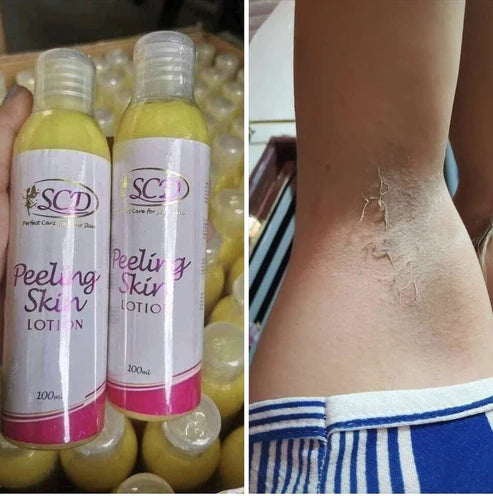 SCD Peeling Lotion 100ml